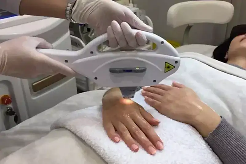 lecheniye_pigmentatsii