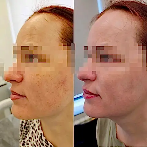 Фотошоп в реальной жизни? Нет!