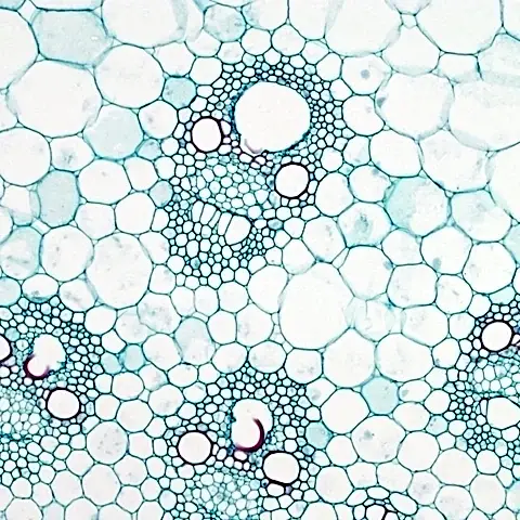 Влияние филлеров на кожу